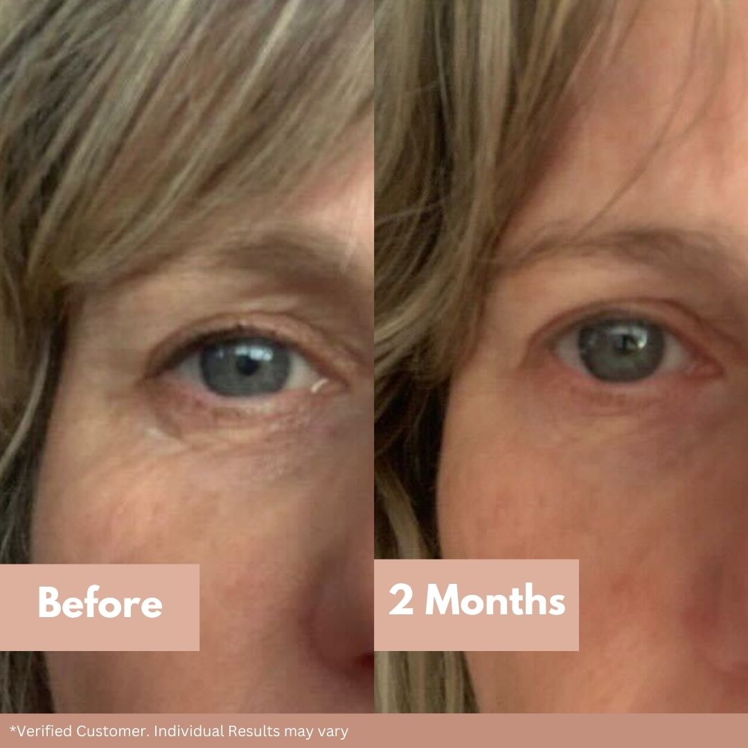 Camp Lane Skincare Retinol Eye Balm to nourish and rejuvenate.